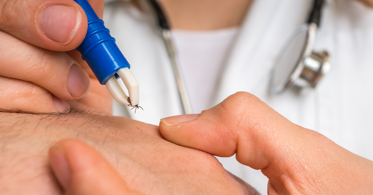 5 Common Misconceptions About Lyme Disease
