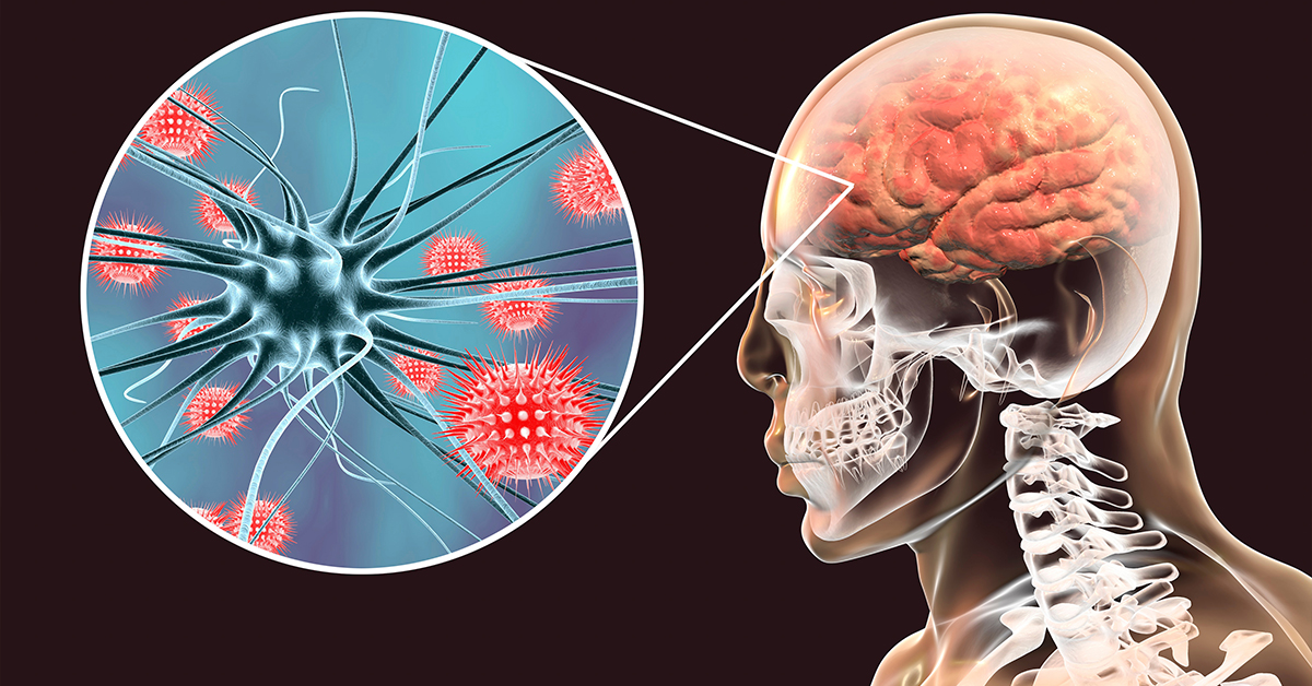 Mosquito-Borne Disease: Eastern Equine Encephalitis