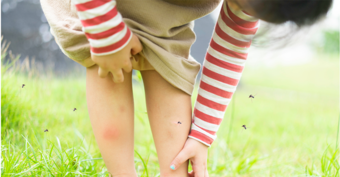 Three Home Remedies for Treating Mosquito Bites