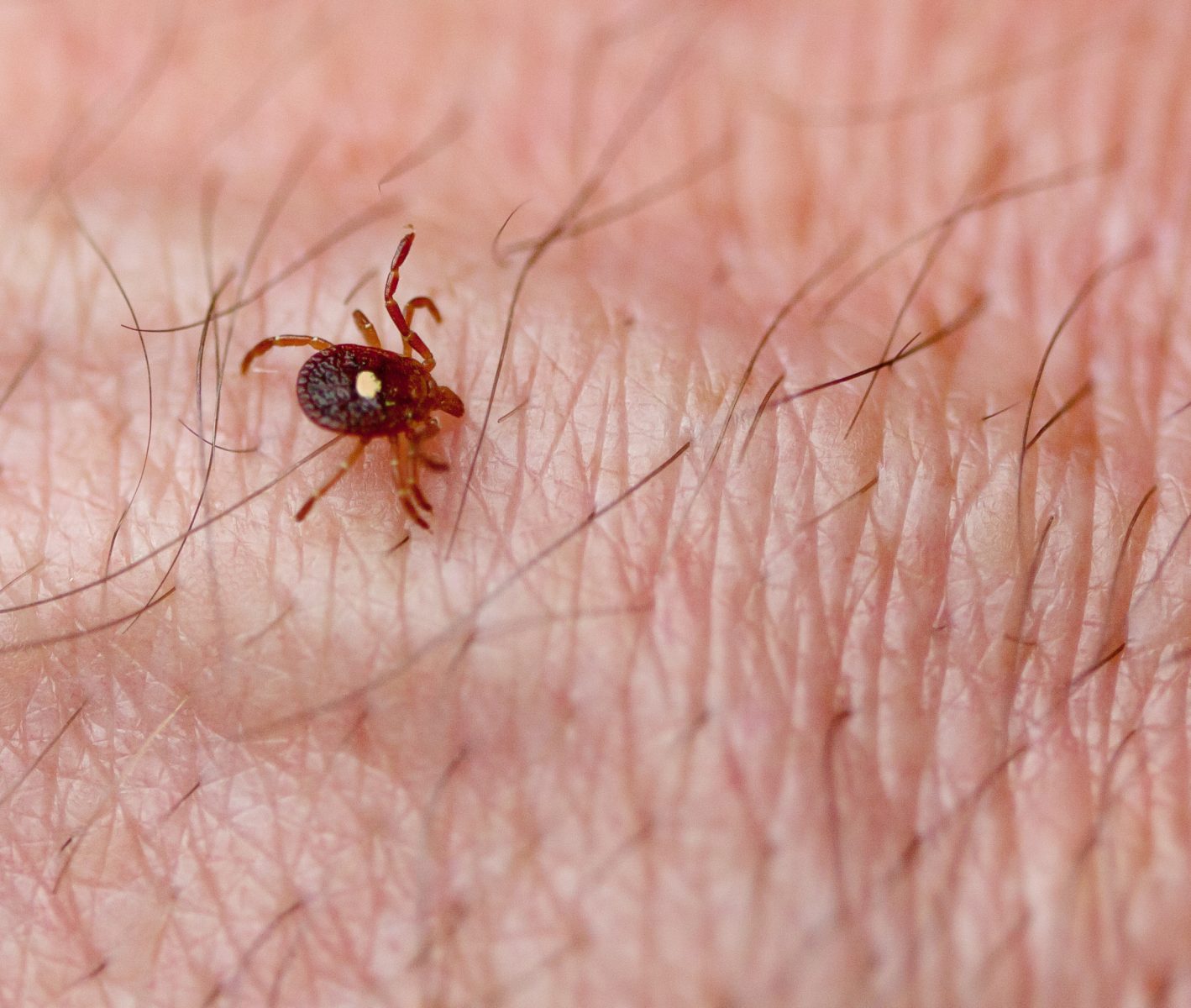 Chiggers or Lone Star Ticks on Long Island