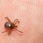 Lone Star tick on skin