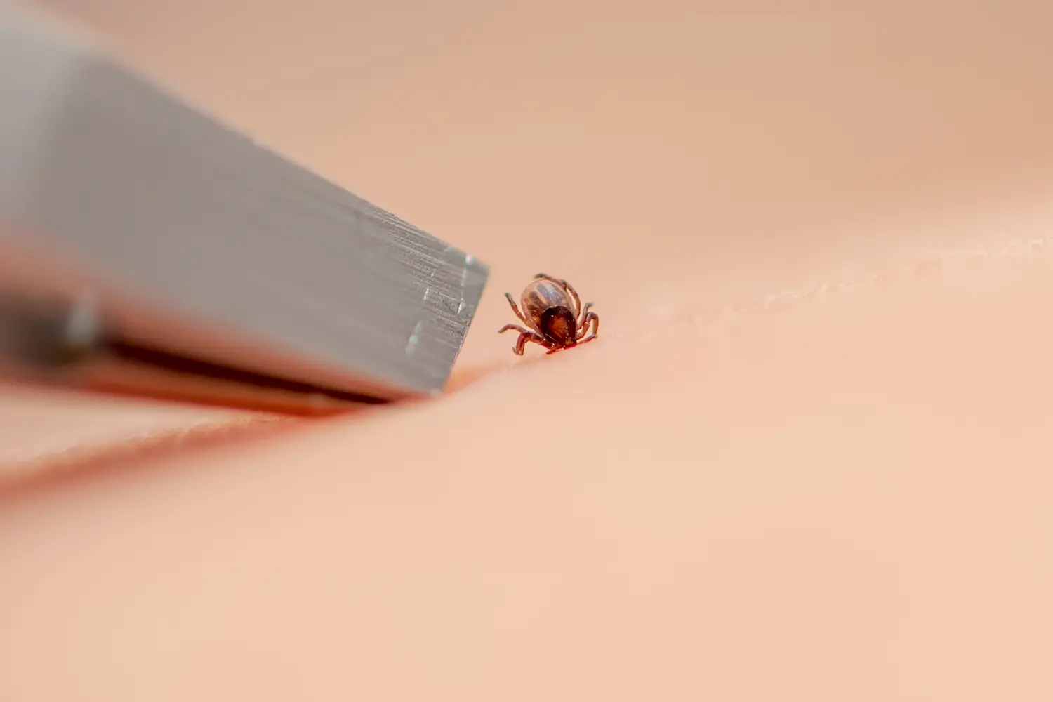 closeup of someone using tweezers to remove a tick in skin